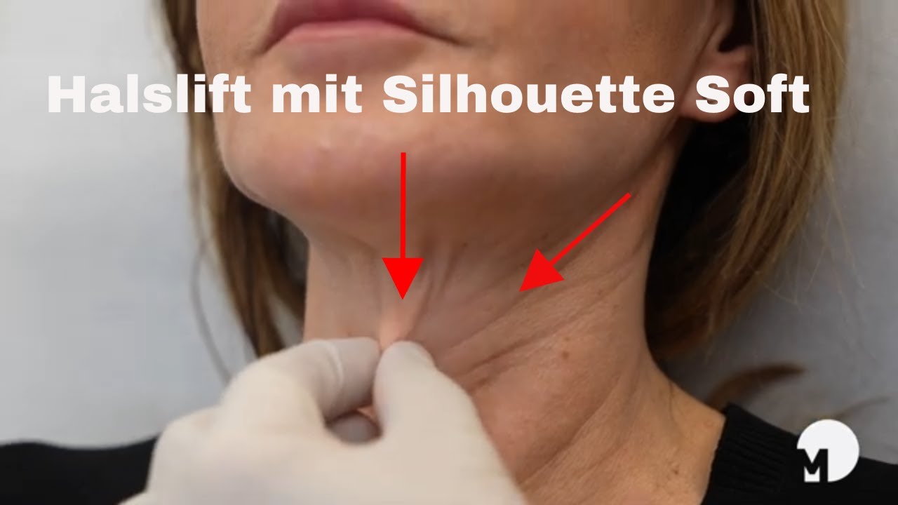 Christian Roessing-10