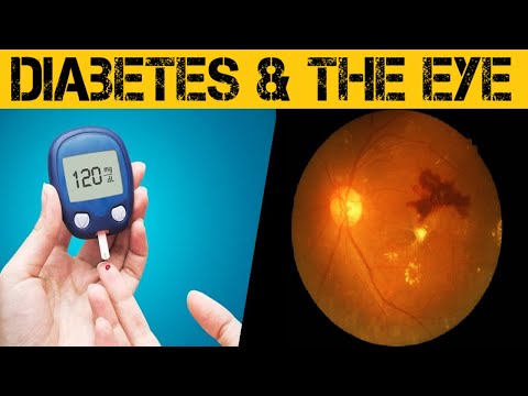 Understanding Diabetic Eye Disease