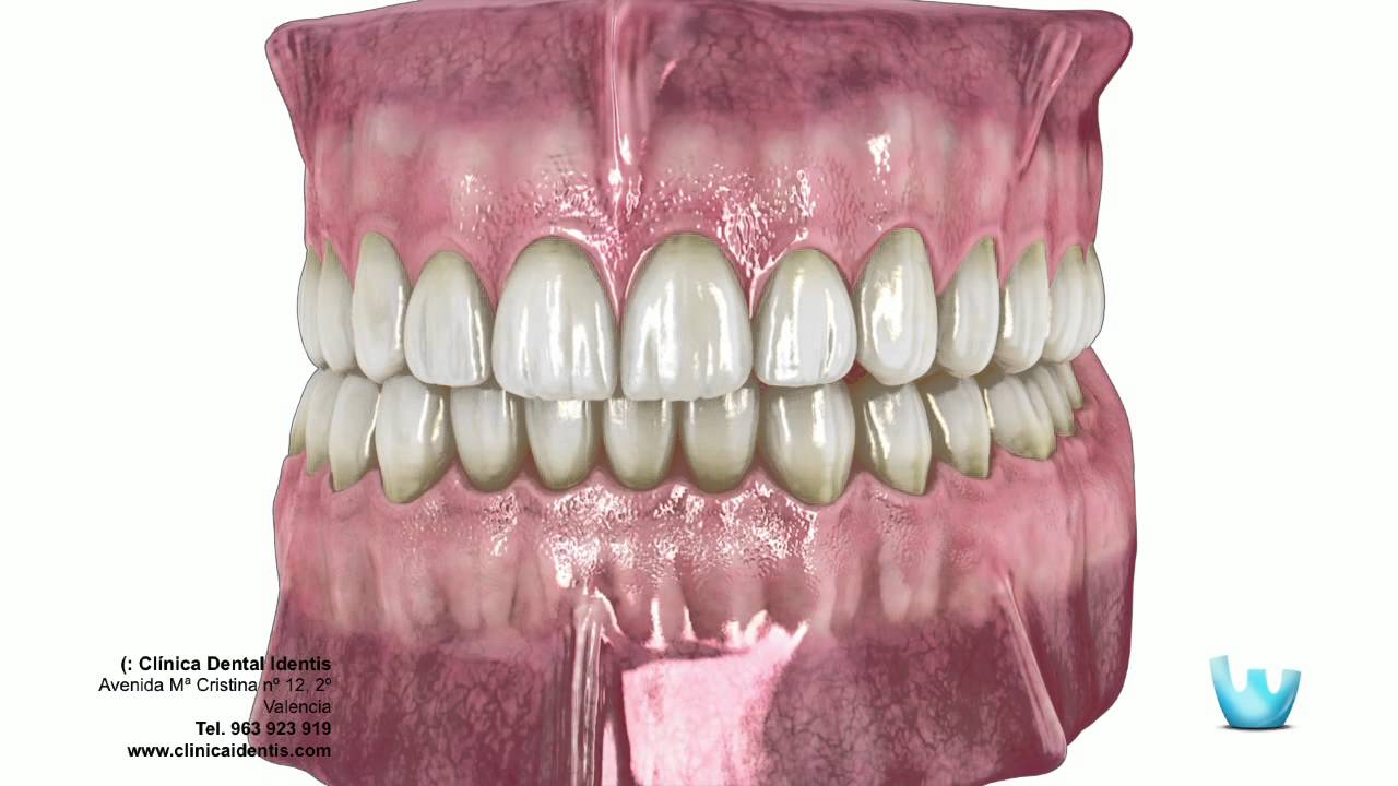 Jose David Torres Hernandez-30