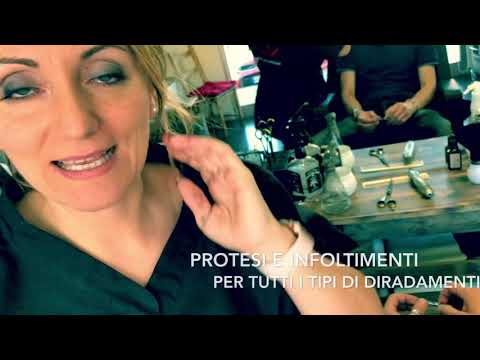 ALOPECIA CICATRIZIALE SOLUZIONE 🔜🎥🔝😍