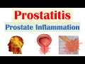 Prostatitis Prostate Inflammation Different Types Causes Signs Symptoms Diagnosis Treatment