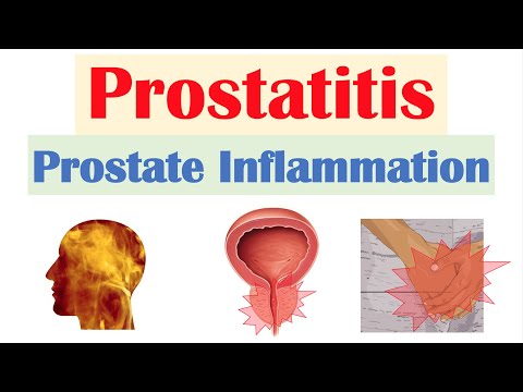 Változtassa meg a vizeletet a prostatitisben