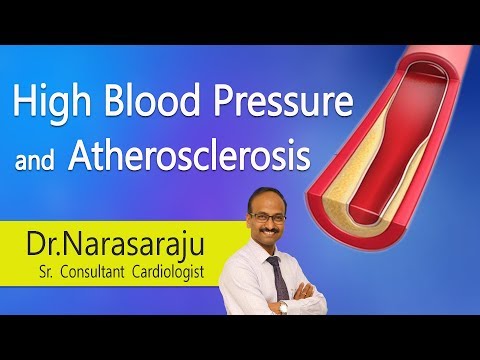 Hi9 | High Blood Pressure and Atherosclerosis | Dr K Narasa Raju | Cardiologist