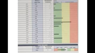 Alternative Treatments of Cataracts