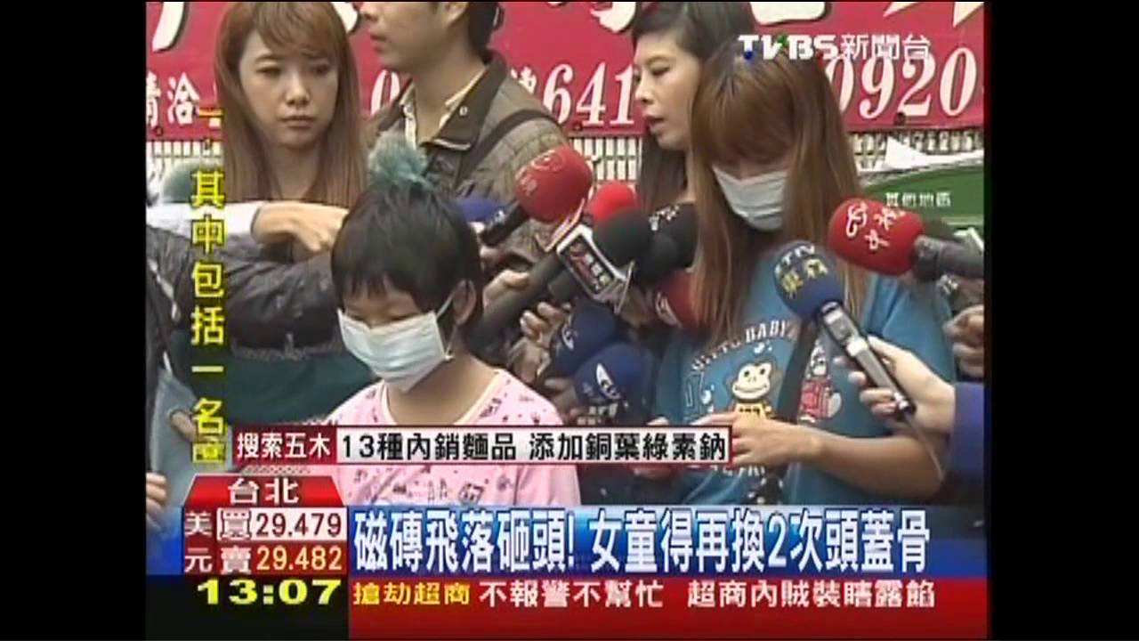 磁磚飛落砸頭! 女童得再換2次頭蓋骨