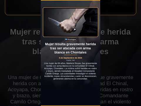 Mujer resulta gravemente herida tras ser atacada con arma blanca en Chontales