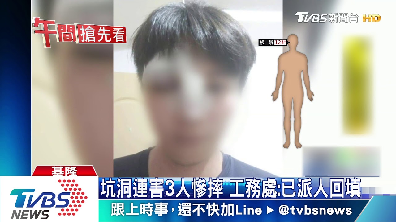 熊貓眼!雨天坑洞積水害摔 騎士縫24針