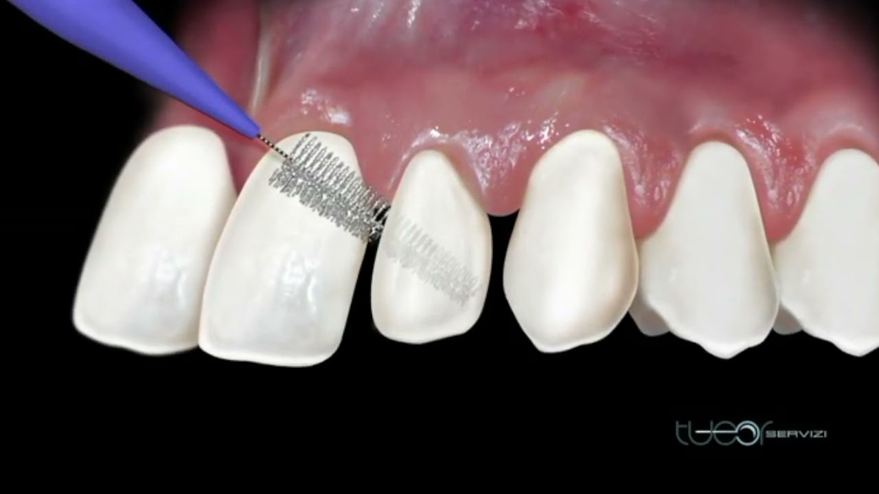Lo strumento migliore per pulire tra dente e dente