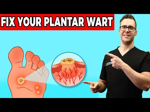 20 Ways To Get Rid of Toenail Fungus Proven CURE Home Remedies