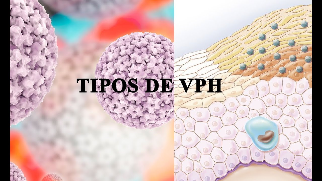 María Denisse Alvarez Huanca-13