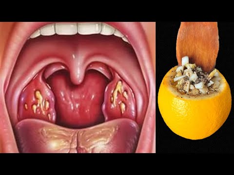 KILLS Throat Pain and Inflammation in 1 Day! Effective Recipes! From coughing from flu 💯