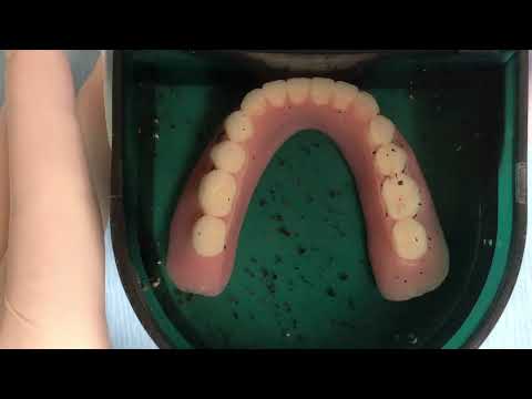 How to clean a DIRTY Denture!