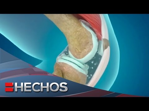 Dolor en la articulación endurecido Enfermedad de la articulación temporomandibular