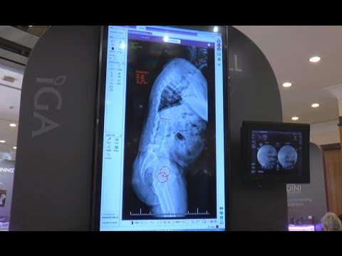 Osteocondrosi della colonna cervicale per quanto tempo La sindrome psicosomatica in osteocondrosi