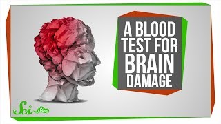 A Blood Test for Brain Damage, and AI Eye Doctors