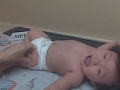 11 Months Baby S Vaccine Shots