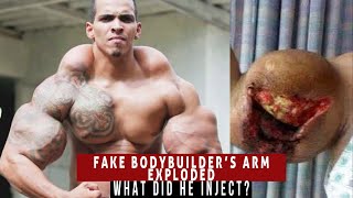 Fake Bodybuilders Died By Injecting This | Meet The Reality ( Must Watch ) | Saheb Singh | video