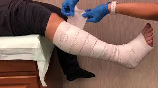 Product video: TwoPress 2 Lite 2-Layer Compression Bandaging System