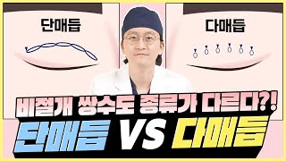 쌍수, 매듭에 따라서 결과가 달라진다! - 닥터 김태훈