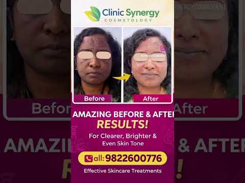 Transformation Before and After | Dr. Dipali Dambal