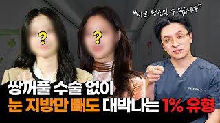 쌍꺼풀 없이 '지방만' 빼도 드라마틱한 효과!  지방 제거만으로 성공하는 '1% 유형'의 눈 특징은?