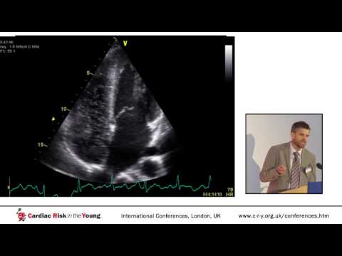Right Ventricular Adaptation to Exercise: The Weak Link of the Athletic Heart?