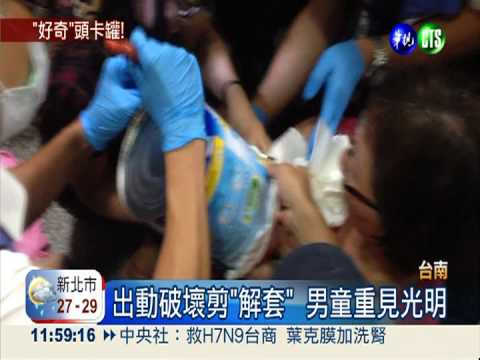 奶粉罐套頭拔不出 1歲男童哭慘