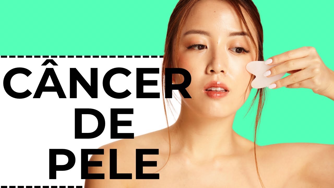 Câncer de pele! Nutricionista Sunayk