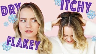 Winter Scalp is the WORST - How to Fix It!!