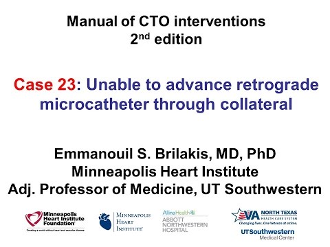 Case 23: Manual of CTO Interventions - Retrograde microcatheter will not cross