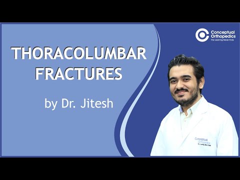 Thoracolumbar Fracture & Management @ConceptualOrthopedics