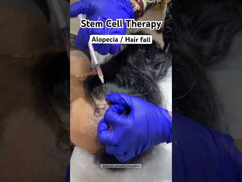 Advanced Stem Cell Therapy for Alopecia in Bangalore, India
