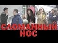 Приколы над людьми. Сломанный нос. Выпуск 6 