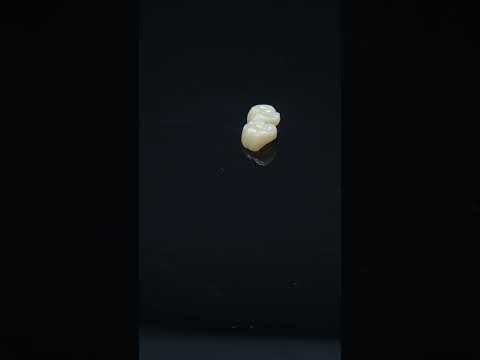 YouTube 썸네일