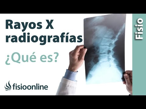 RX o radiografía - ¿Qué es y cómo funciona?