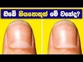 does-your-fingernails-look-like-this?-