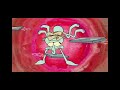 SpongeBob SquarePants Production Music Abandon Twits Unknown Music Track