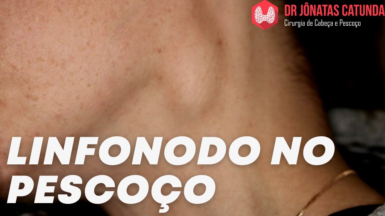 Linfonodo no pescoço  que surgiu do nada