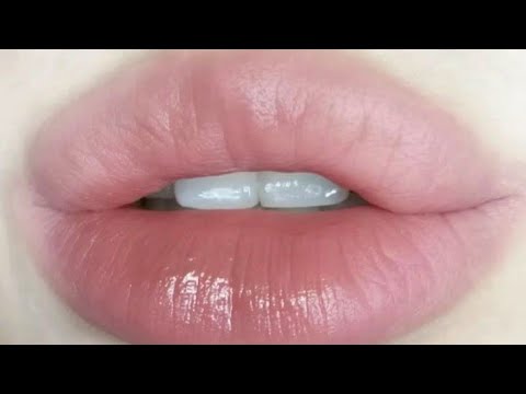 experimental upper lip inflation + lift