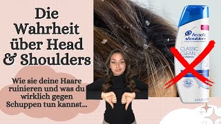 Die schockierende Wahrheit über Head & Shoulders | Wie es deine Haare ruiniert & Tipps bei Schuppen
