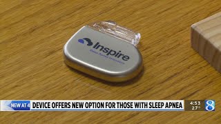 New internal device helps with sleep apnea
