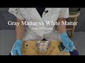 Gray Matter vs White Matter: Learn Integral Anatomy with Gil Hedley