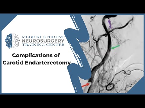 Complications of Carotid Endarterectomy