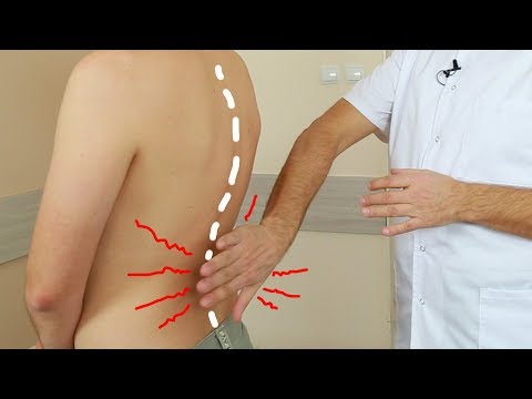 Artrózis a könyökízületben