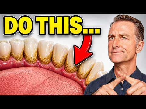 The #1 Top Remedy for Dental Plaque (TARTAR)