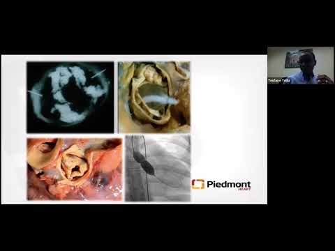 Intro to Structural Heart Disease: Aortic Valve diseases