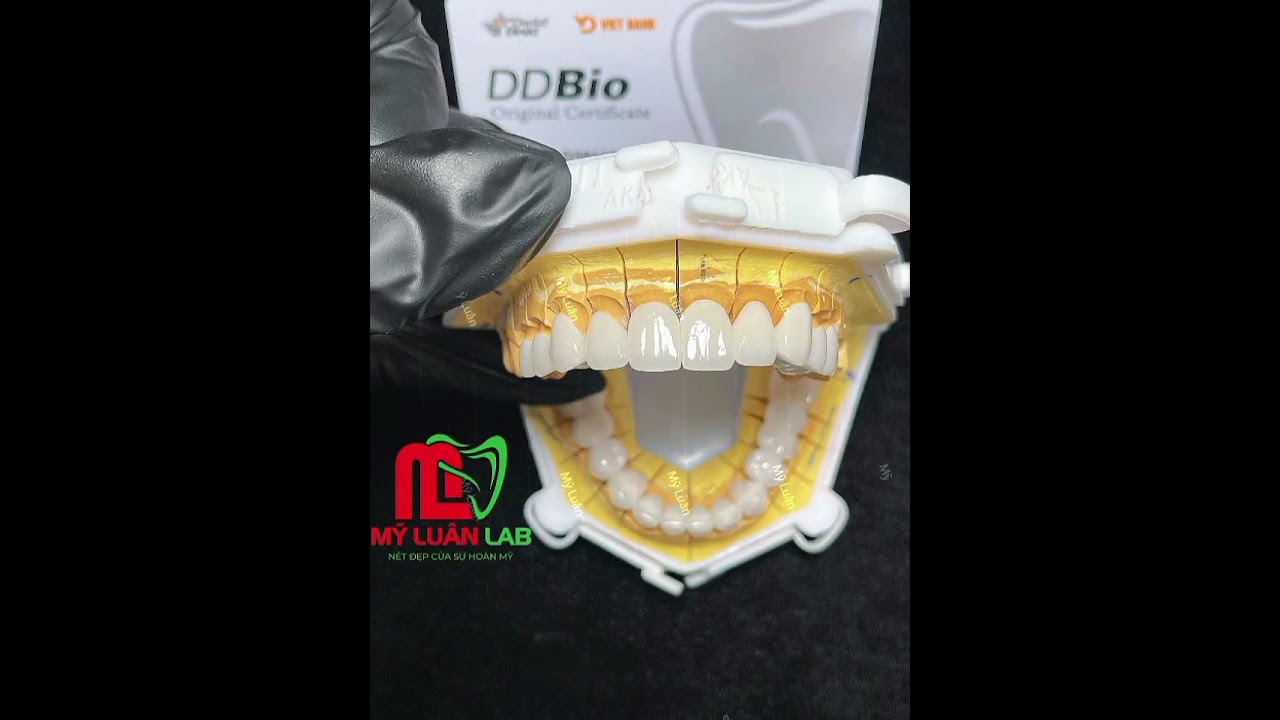 Răng Sứ DDBIO – Tinh Hoa Sứ Sinh Học Cho Nụ Cười Hoàn Mỹ | Mỹ Luân Lab