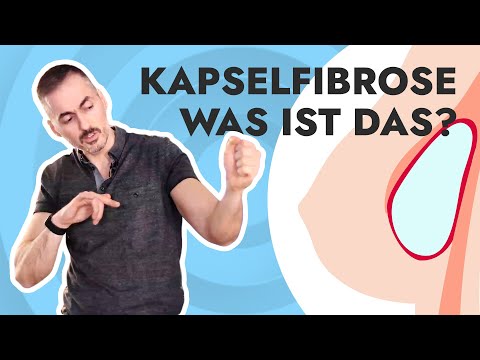 Dein Plastic Surgery Coach - Was ist eine Kapselfibrose?