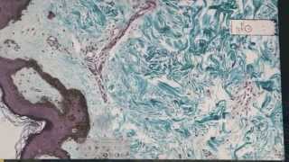 Ghostpoet - Shedding Skin (Behind The Artwork)