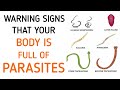 Don't Ignore These Early Symptoms Of Parasites In Your Body